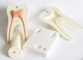 Model anatomiczny zęba duży 3-częściowy