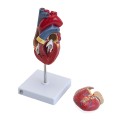 anatomiczny model serca człowieka